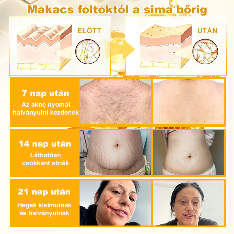 🍑⭐VLSVLS® méhméreges bőrmegújító krém(CE Tanúsítvány) 👍 ✅